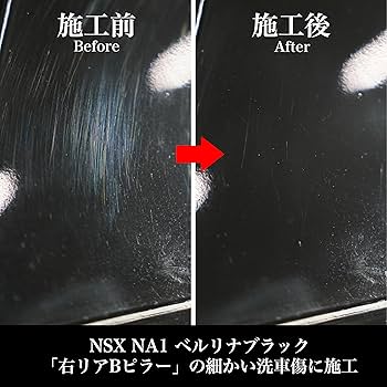 Amazon.co.jp: 【SHIBUI】REGENE BASE｜小傷を優しく落として